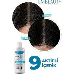 Embeauty 9 Aktifli - Natural Anti Hair Loss